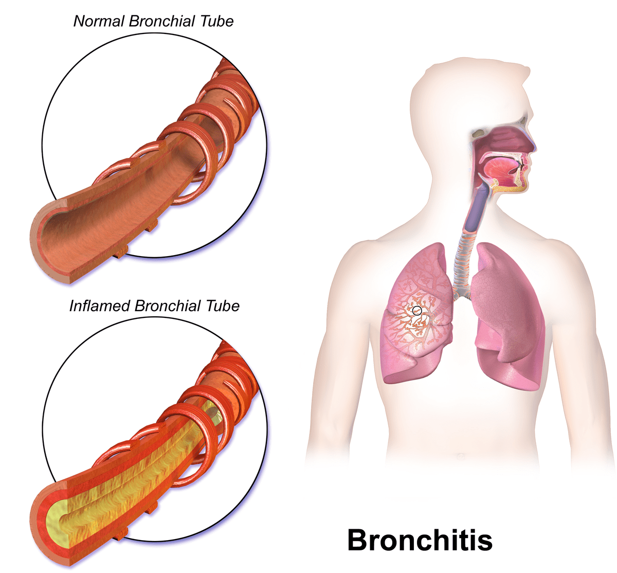 Diseases due to unhealthy immune system