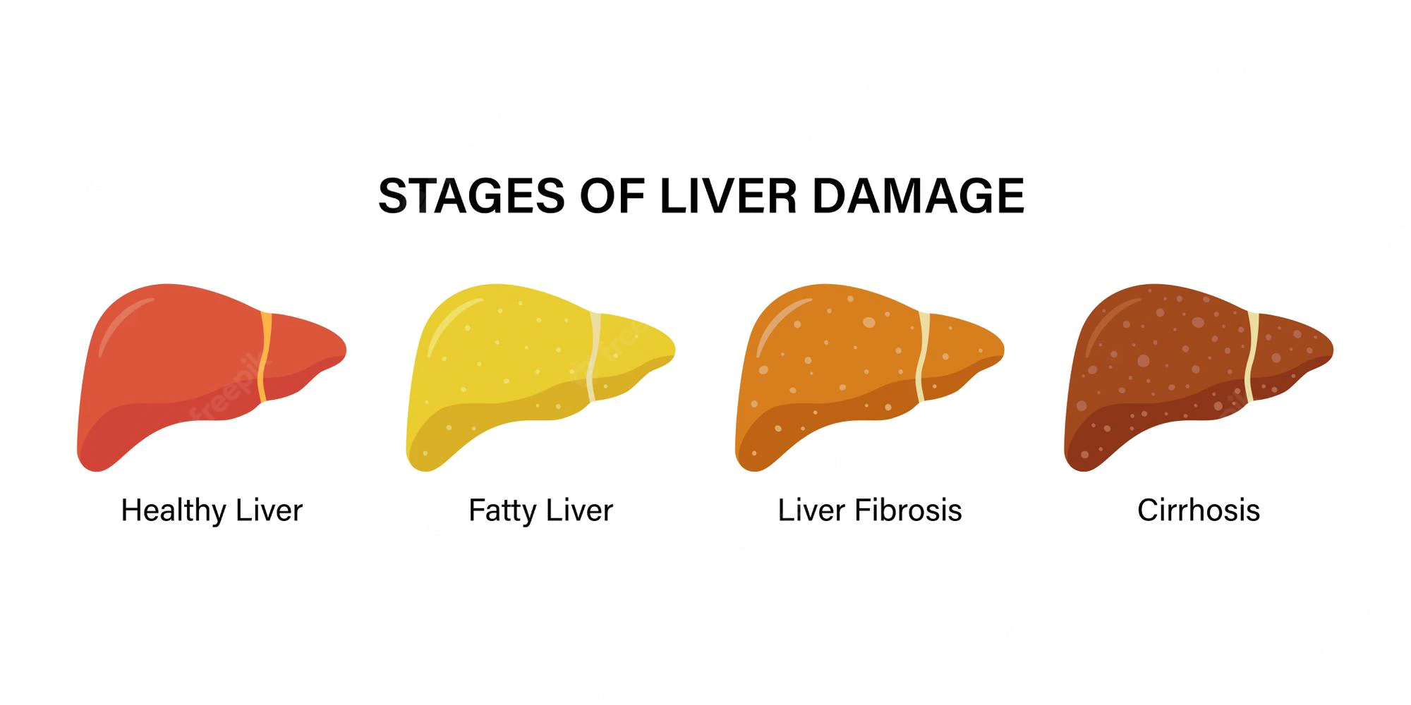 Diseases affecting liver